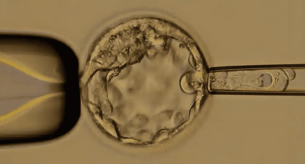 警惕！试管婴儿路上的“10大坑”：理性避坑指南